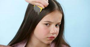 Kako istrebiti vaške na glavi?