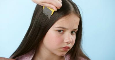 Kako istrebiti vaške na glavi?