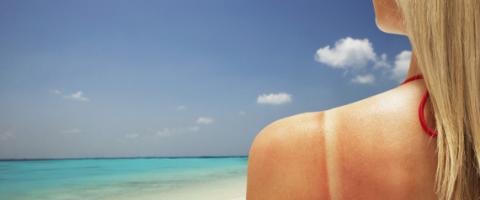 Kako oporaviti kožu posle sunčanja?